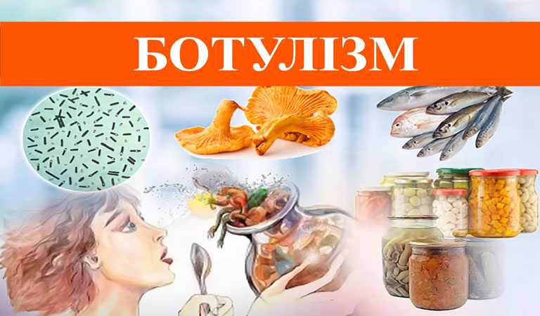 Ботулізм